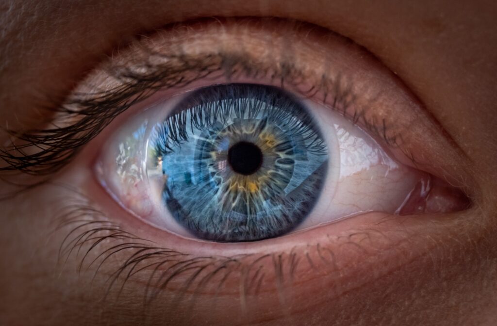 A close up of an eye, showing a contact lens fitted on the surface.